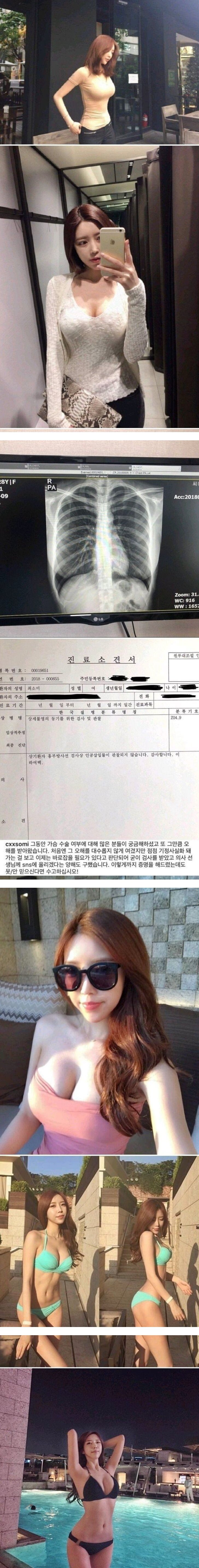 콘텐츠 이미지