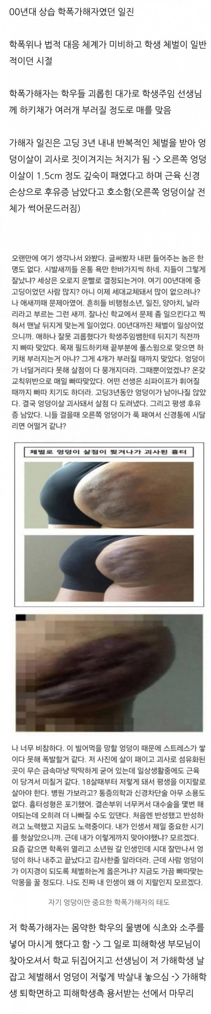 추천콘텐츠 썸네일